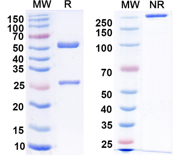 Anti-TRAK2 Recombinant Monoclonal Antibody (N390/46) - SDS-PAGE