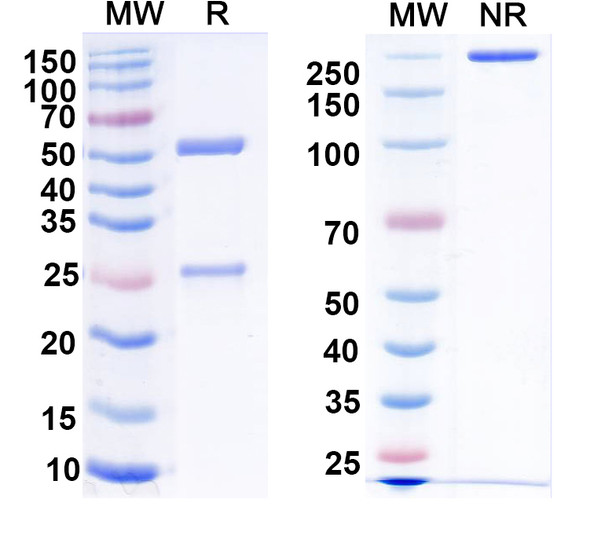 Anti-SUR2A Recombinant Monoclonal Antibody (N319A/34) - SDS-PAGE