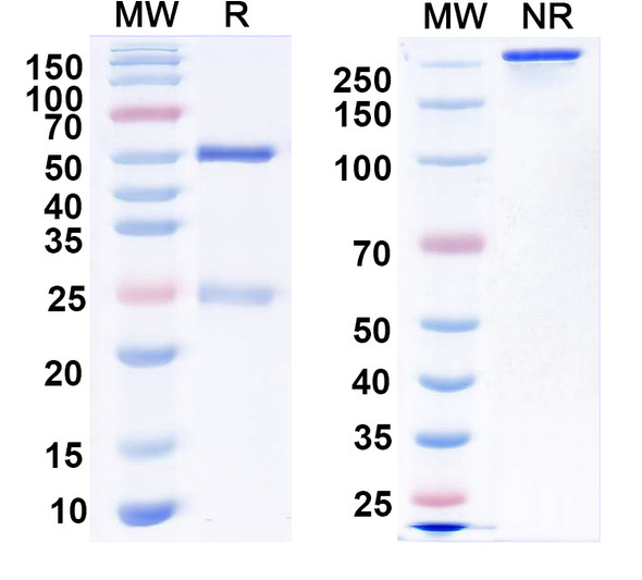 Anti-SUR2B Recombinant Monoclonal Antibody (N323A/52) - SDS-PAGE
