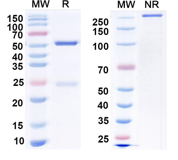 Anti-SUR2B Recombinant Monoclonal Antibody (N323A/53) - SDS-PAGE