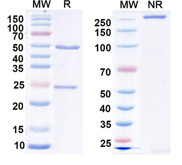 Anti-LRP4 Recombinant Monoclonal Antibody (N164/6) - SDS-PAGE