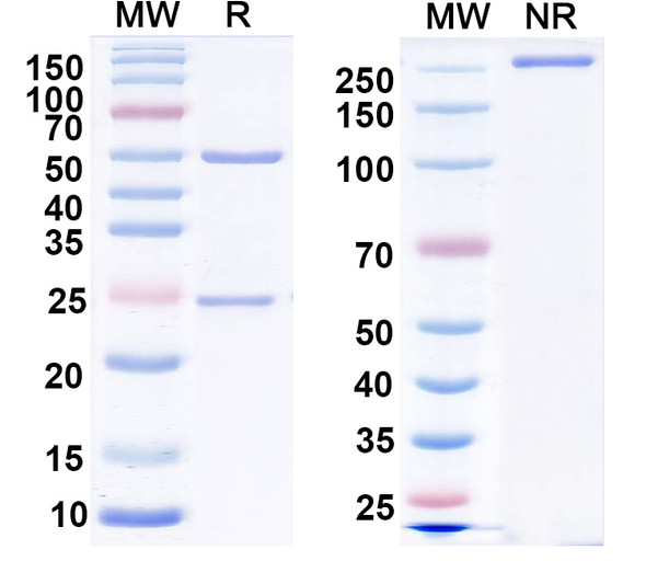 Anti-LRP4 Recombinant Monoclonal Antibody (N207/27) - SDS-PAGE