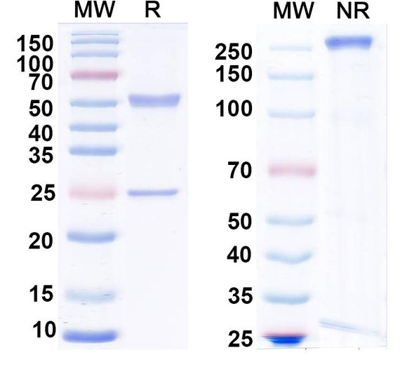 Anti-JMJD2A Recombinant Monoclonal Antibody (N154/32) - SDS-PAGE