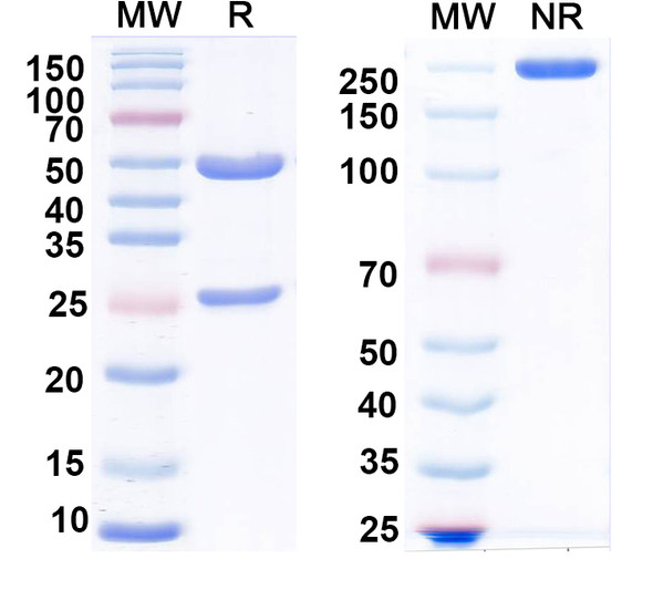 Anti-LGR5/GPR49 Recombinant Monoclonal Antibody (L63/22) - SDS-PAGE
