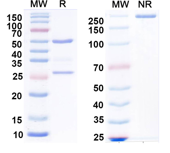 Anti-BAF53b Recombinant Monoclonal Antibody (N332B/15) - SDS-PAGE
