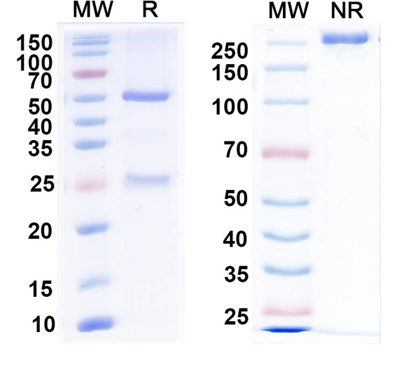 Anti-Mitofusin-2 Recombinant Monoclonal Antibody (N153/3) - SDS-PAGE