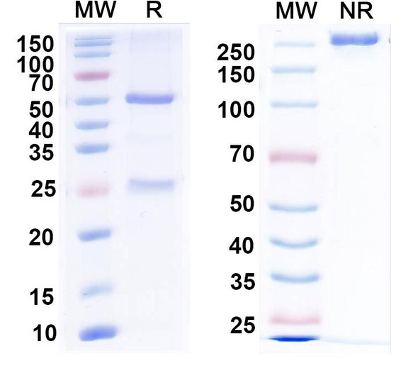 Anti-Mitofusin-2 Recombinant Monoclonal Antibody (N153/5) - SDS-PAGE