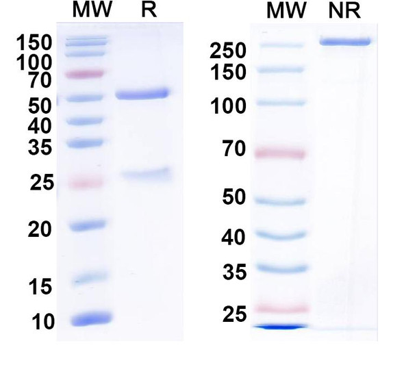 Anti-Laforin Recombinant Monoclonal Antibody (N84/1) - SDS-PAGE