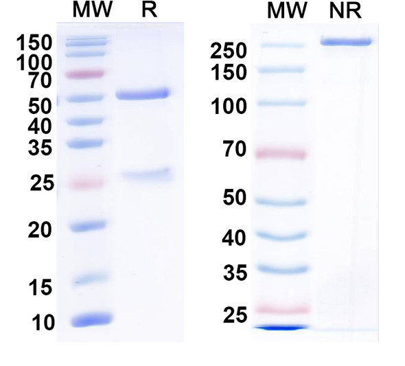 Anti-VAPB Recombinant Monoclonal Antibody (N484/67) - SDS-PAGE