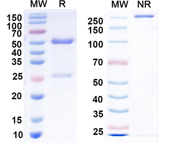 Anti-Snapin/SNAPAP Recombinant Monoclonal Antibody (L8/15) - SDS-PAGE