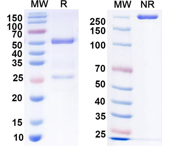 Anti-CNIH Recombinant Monoclonal Antibody (N200/7) - SDS-PAGE
