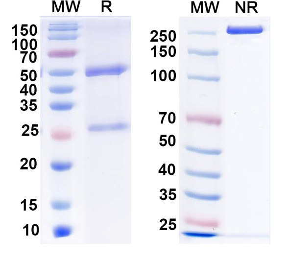 Anti-SAPAP3 Recombinant Monoclonal Antibody (L126/93) - SDS-PAGE