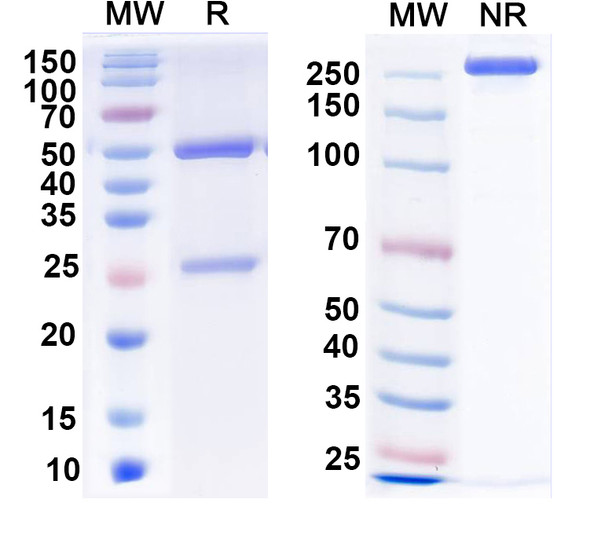Anti-Lgi1 Recombinant Monoclonal Antibody (N283/7) - SDS-PAGE