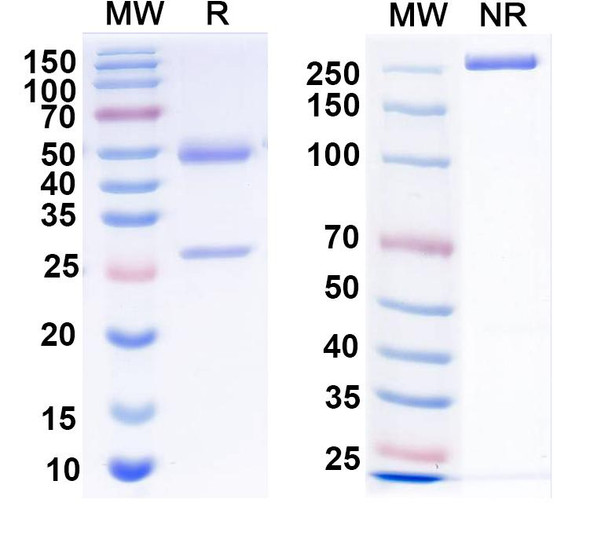 Anti-Calbindin Recombinant Monoclonal Antibody (L109/39) - SDS-PAGE