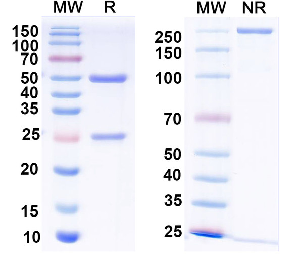 Anti-Beta-1 adrenergic receptor Recombinant Monoclonal Antibody (N477/45) - SDS-PAGE