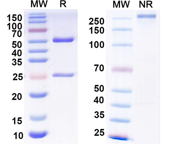 Anti-LAR/PTPRF Recombinant Monoclonal Antibody (N165/58) - SDS-PAGE