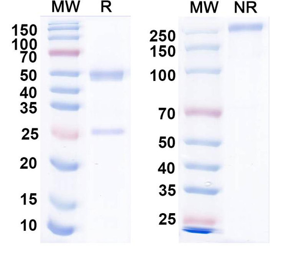 Anti-EF2 Recombinant Monoclonal Antibody (N265/38) - SDS-PAGE