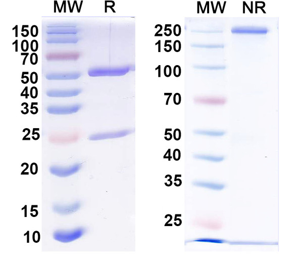 Anti-Dopamine D2 receptor Recombinant Monoclonal Antibody (N186/26) - SDS-PAGE