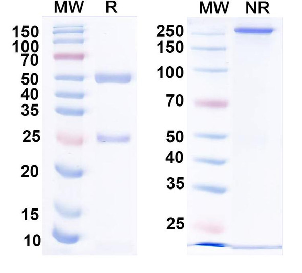 Anti-Ankyrin-R Recombinant Monoclonal Antibody (N388A/10) - SDS-PAGE