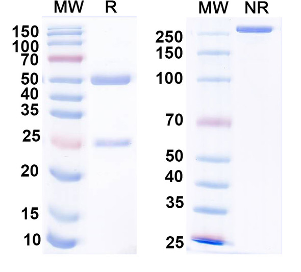 Anti-Alpha-2C adrenergic receptor Recombinant Monoclonal Antibody (N378/107) - SDS-PAGE