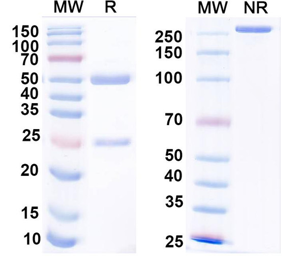 Anti-Parvalbumin Recombinant Monoclonal Antibody (L114/82) - SDS-PAGE