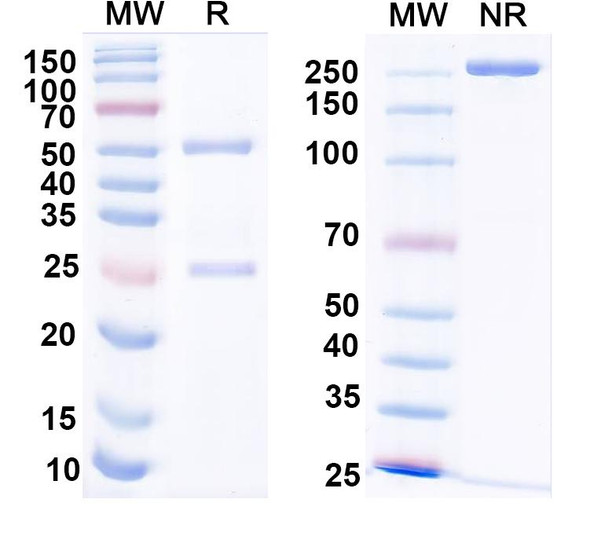 Anti-Cannabinoid receptor 1 Recombinant Monoclonal Antibody (L112/22) - SDS-PAGE