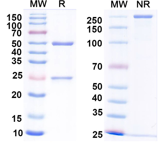 Anti-Calretinin Recombinant Monoclonal Antibody (L122/6) - SDS-PAGE