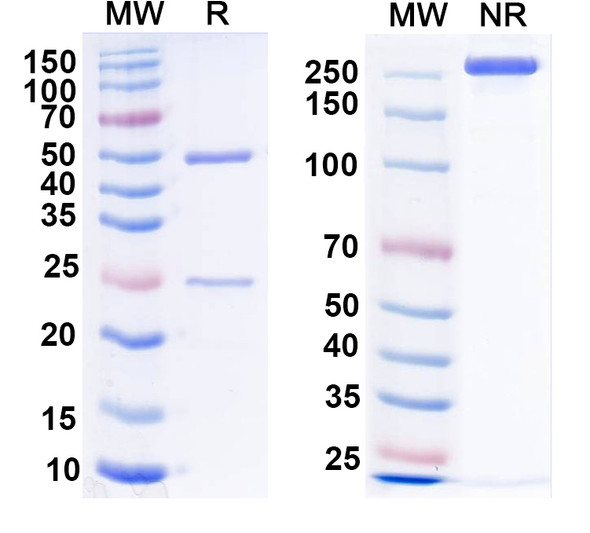 Anti-IP3 receptor, type 1 Recombinant Monoclonal Antibody (L24/18) - SDS-PAGE