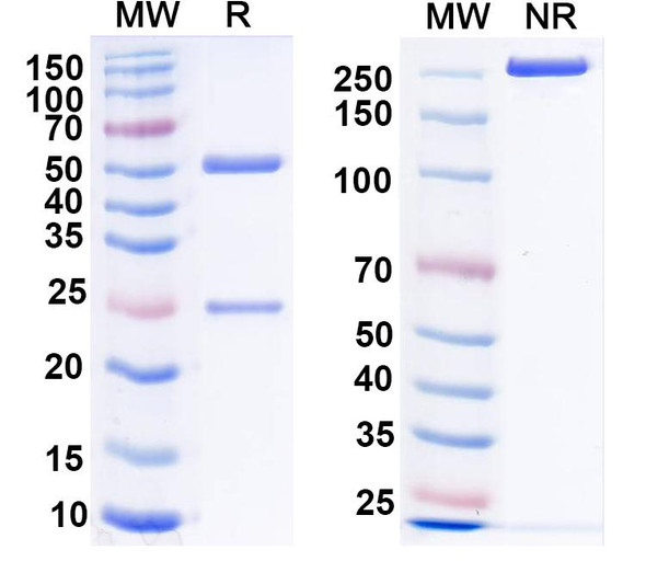Anti-nNOS/NOS1 Recombinant Monoclonal Antibody (L121/25) - SDS-PAGE