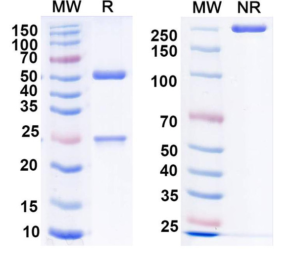 Anti-nNOS/NOS1 Recombinant Monoclonal Antibody (L121/58) - SDS-PAGE