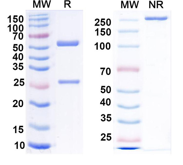 Anti-CCK Recombinant Monoclonal Antibody (L110/55) - SDS-PAGE