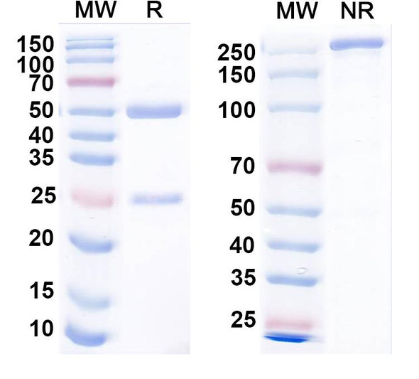 Anti-S100A5 Recombinant Monoclonal Antibody (N176A/35) - SDS-PAGE