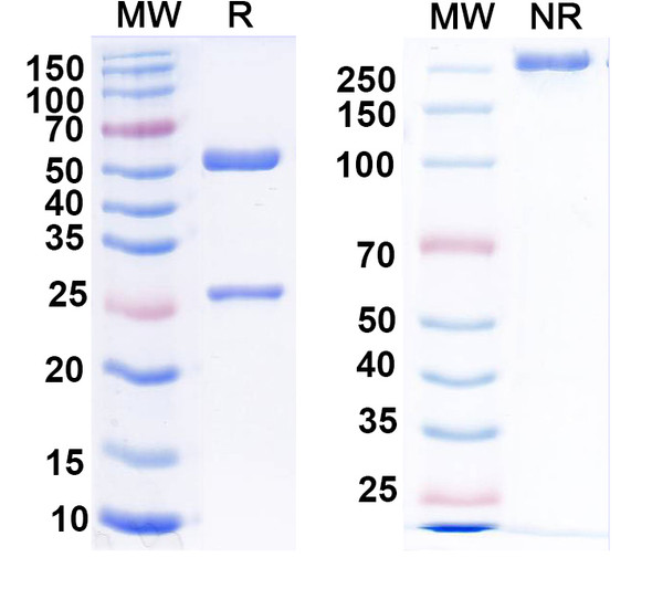Anti-Nav1.4 Na+ channel Recombinant Monoclonal Antibody (N255/4) - SDS-PAGE