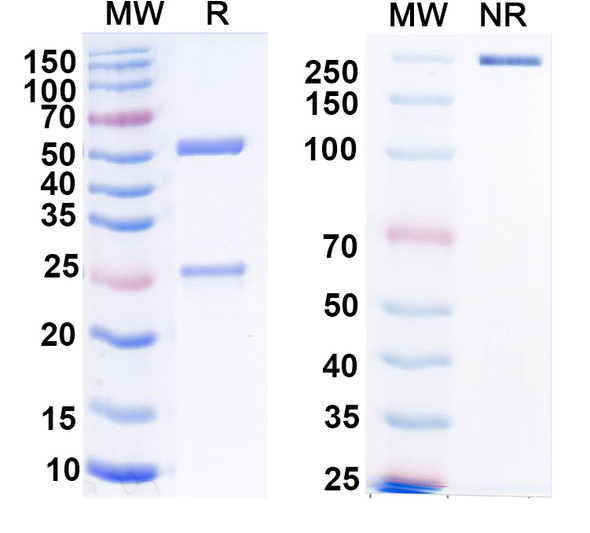 Anti-Clcn1 Recombinant Monoclonal Antibody (N305/2) - SDS-PAGE