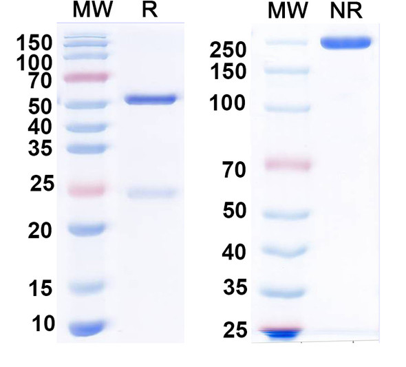 Anti-PIGA Recombinant Monoclonal Antibody (N462/29) - SDS-PAGE