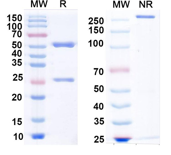 Anti-GluK1/GluR5 kainate receptor Recombinant Monoclonal Antibody (N298/14) - SDS-PAGE