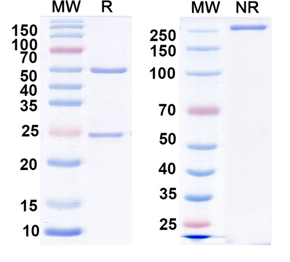 Anti-GluA2/GluR2 glutamate receptor Recombinant Monoclonal Antibody (L21/31) - SDS-PAGE