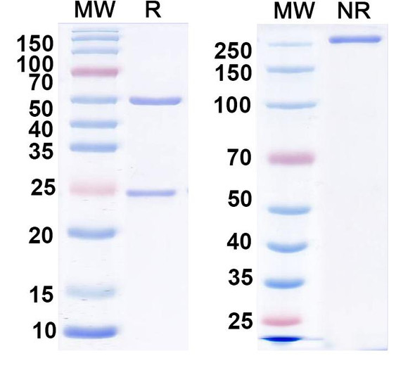 Anti-GluA2/GluR2 glutamate receptor Recombinant Monoclonal Antibody (L21/31) - SDS-PAGE