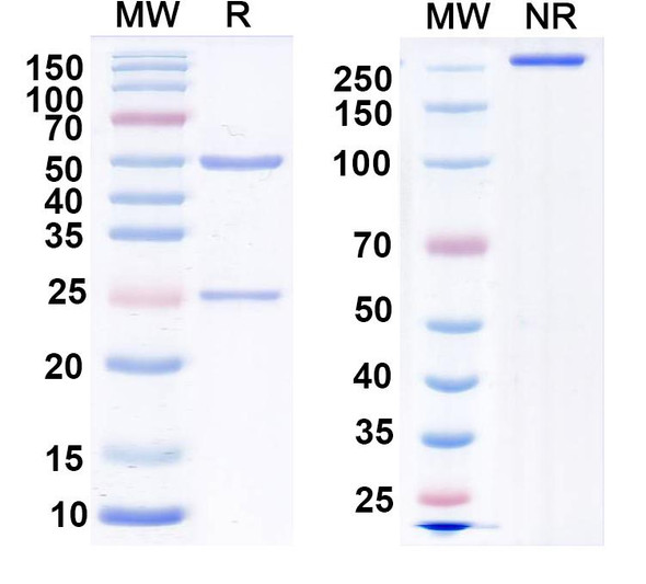 Anti-EAAC1 Recombinant Monoclonal Antibody (N420/64) - SDS-PAGE
