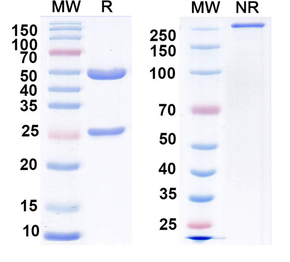 Anti-5-hydroxytryptamine receptor 3A Recombinant Monoclonal Antibody (N401/86) - SDS-PAGE