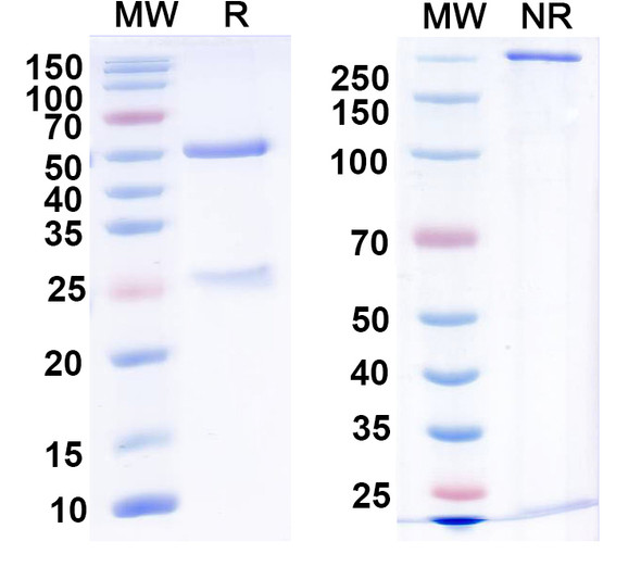 Anti-AE3/SLC4A3 Recombinant Monoclonal Antibody (N242/12) - SDS-PAGE