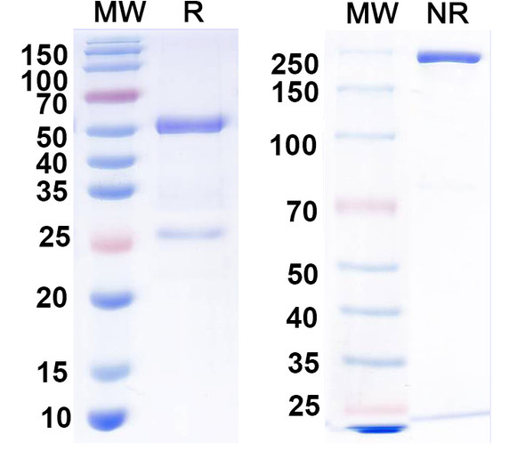 Anti-RGS7 Recombinant Monoclonal Antibody (L3/8) - SDS-PAGE