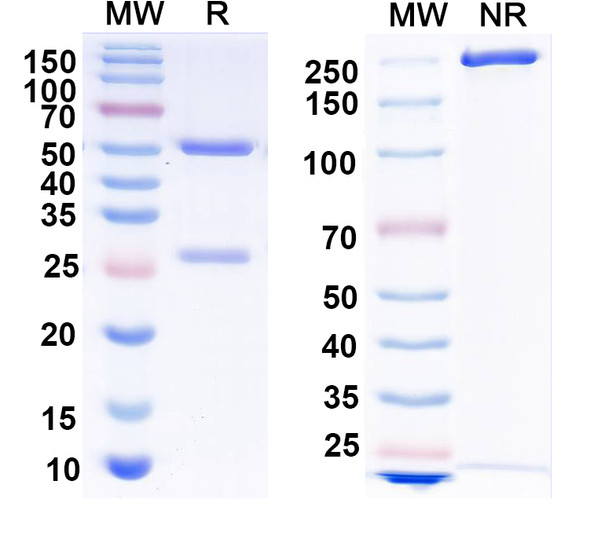 Anti-Clcn4 Recombinant Monoclonal Antibody (N222/9) - SDS-PAGE