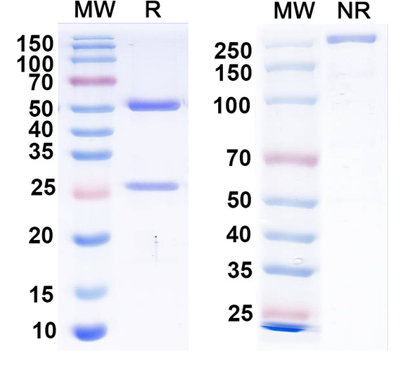 Anti-Clcn7 Recombinant Monoclonal Antibody (N436/47) - SDS-PAGE