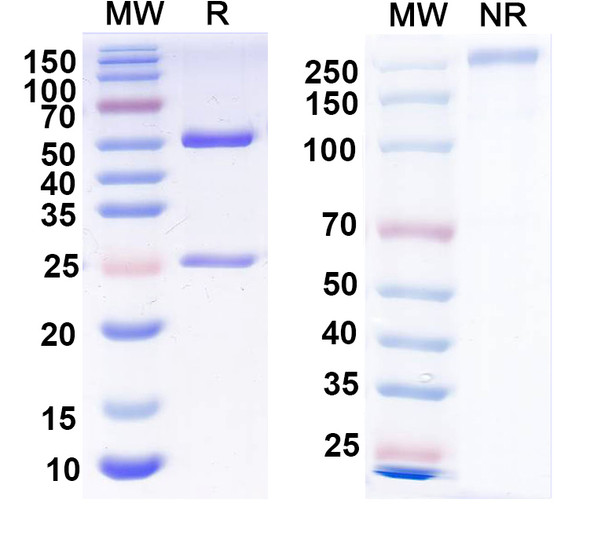 Anti-P2X purinoceptor 4 Recombinant Monoclonal Antibody (N368/12) - SDS-PAGE