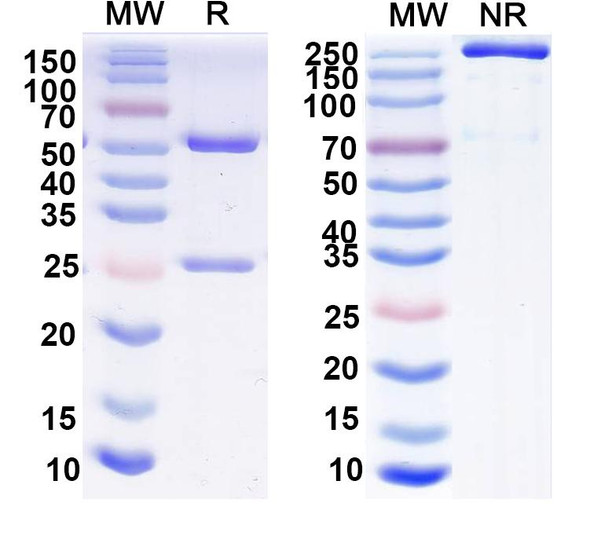 Anti-SST Recombinant Monoclonal Antibody (L111/140) - SDS-PAGE