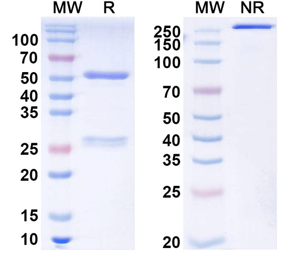 Anti-SST Recombinant Monoclonal Antibody (L111/43) - SDS-PAGE