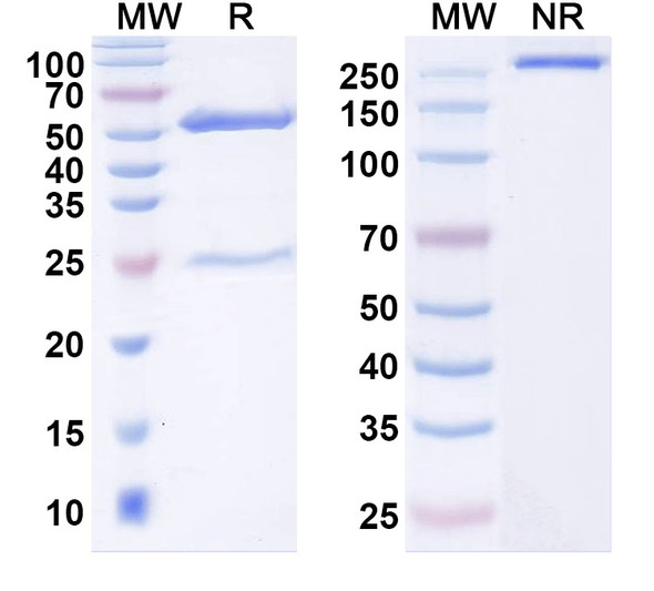 Anti-Ankyrin-B Recombinant Monoclonal Antibody (N105/13) - SDS-PAGE