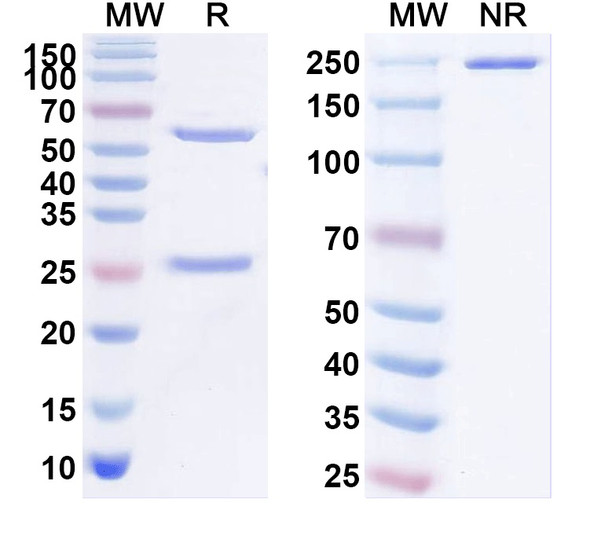 Anti-EGR3 Recombinant Monoclonal Antibody (N216/30) - SDS-PAGE