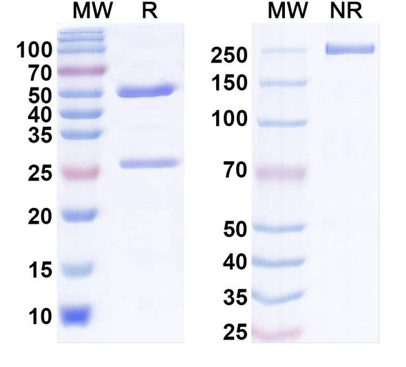 Anti-Contactin/F3 Recombinant Monoclonal Antibody (K73/20) - SDS-PAGE